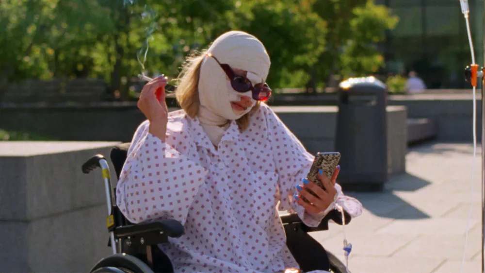 Sick of Myself Has Kristoff Borgli Holding Up a Mirror to the Attention Economy With His Scathing Scandi Satire